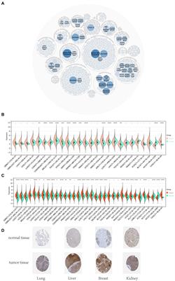 Systematic analysis of virus nucleic acid sensor DDX58 in malignant tumor